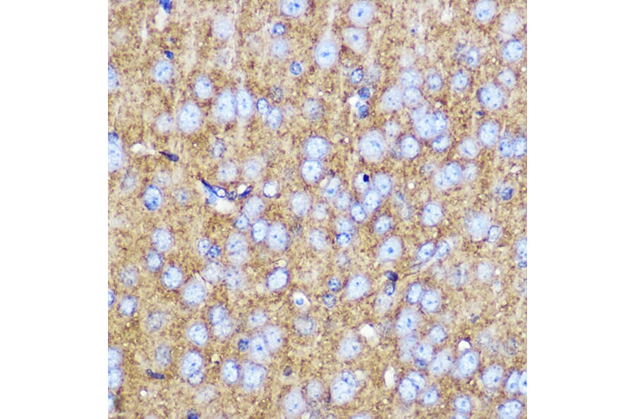 Immunohistochemistry - Anti-SNAP25 Antibody (A12744) - Antibodies.com