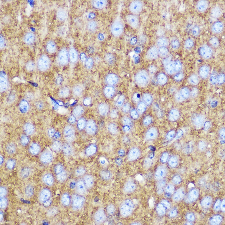 Immunohistochemistry - Anti-SNAP25 Antibody (A12744) - Antibodies.com