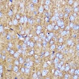 Immunohistochemistry - Anti-SNAP25 Antibody (A12744) - Antibodies.com