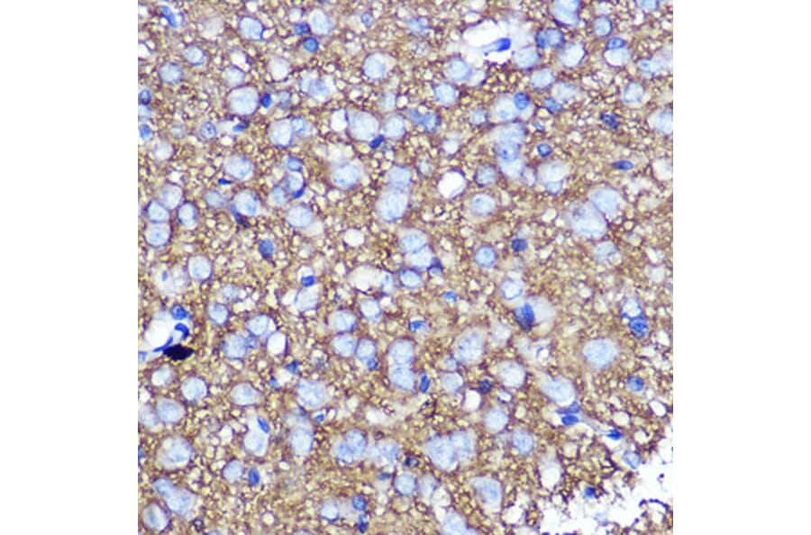 Immunohistochemistry - Anti-SNAP25 Antibody (A12744) - Antibodies.com