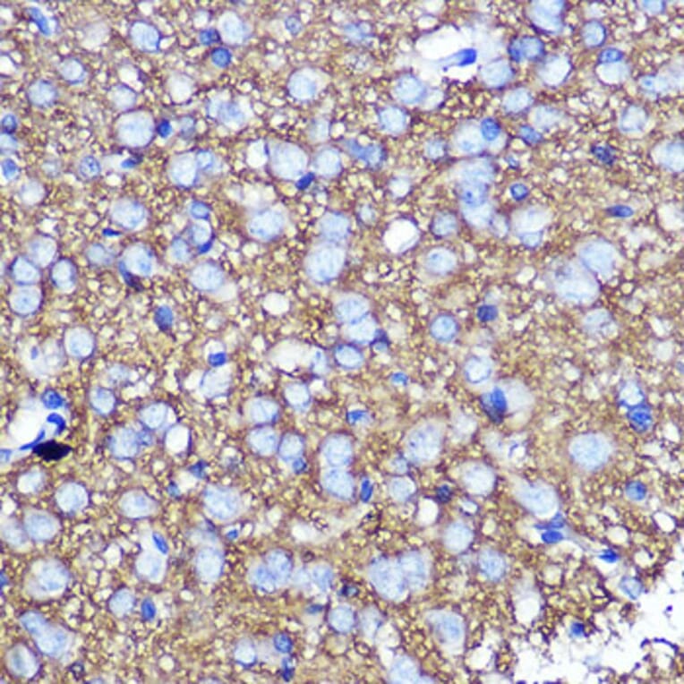 Immunohistochemistry - Anti-SNAP25 Antibody (A12744) - Antibodies.com