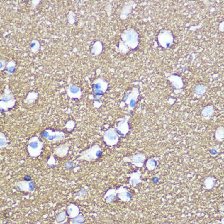 Immunohistochemistry - Anti-SNAP25 Antibody (A12744) - Antibodies.com