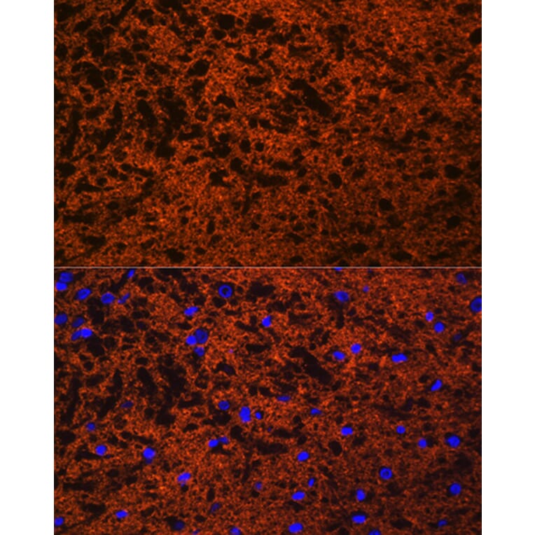Immunofluorescence - Anti-SNAP25 Antibody (A12744) - Antibodies.com