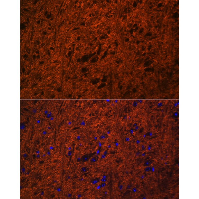 Immunofluorescence - Anti-SNAP25 Antibody (A12744) - Antibodies.com