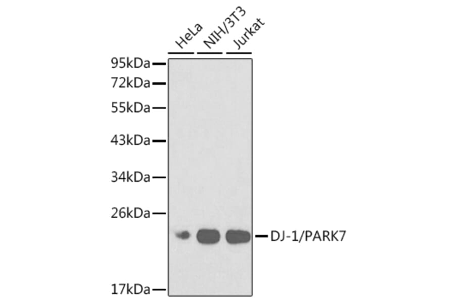 Western Blot - Anti-PARK7/DJ1 Antibody (A12745) - Antibodies.com