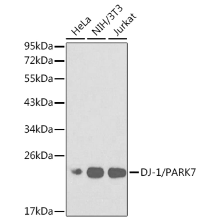 Western Blot - Anti-PARK7/DJ1 Antibody (A12745) - Antibodies.com