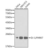 Western Blot - Anti-PARK7/DJ1 Antibody (A12745) - Antibodies.com