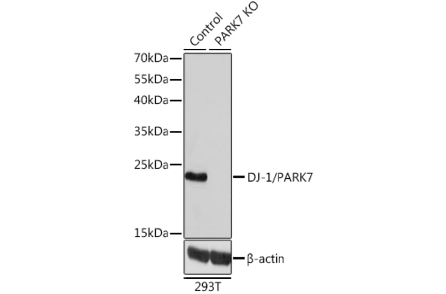 Western Blot - Anti-PARK7/DJ1 Antibody (A12745) - Antibodies.com