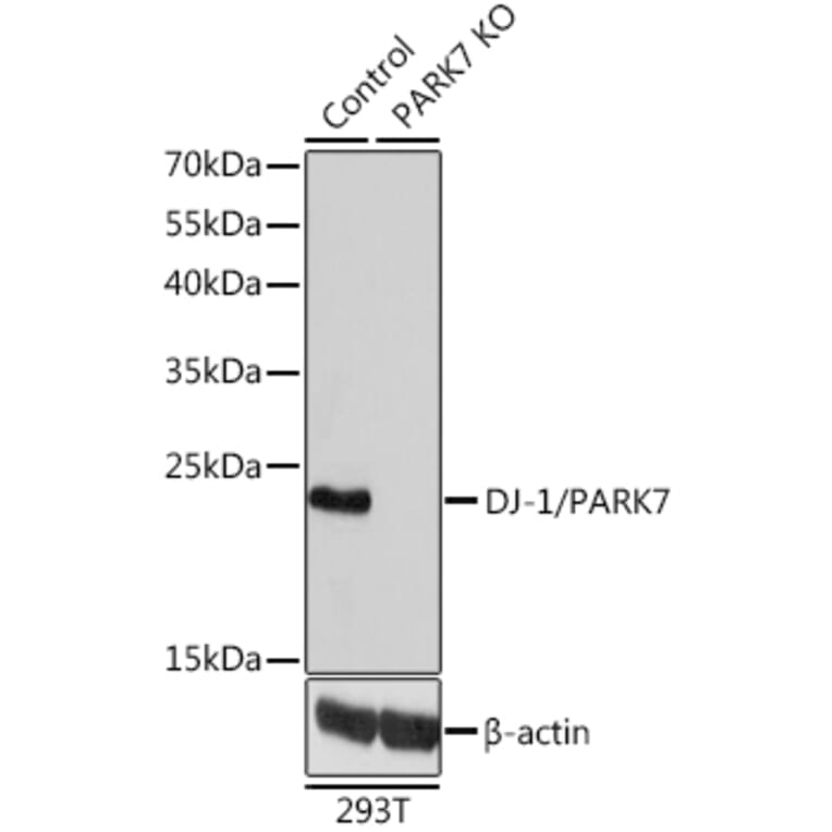Western Blot - Anti-PARK7/DJ1 Antibody (A12745) - Antibodies.com