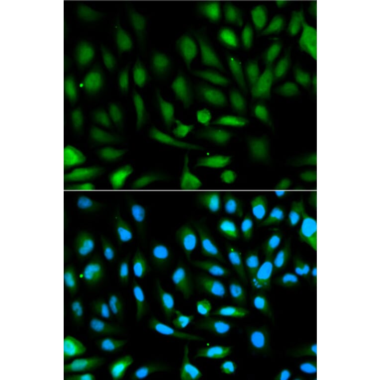 Immunofluorescence - Anti-PARK7/DJ1 Antibody (A12745) - Antibodies.com