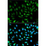 Immunofluorescence - Anti-PARK7/DJ1 Antibody (A12745) - Antibodies.com