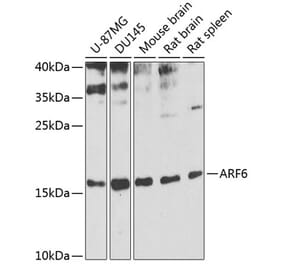 Western Blot - Anti-ARF6 Antibody (A12746) - Antibodies.com