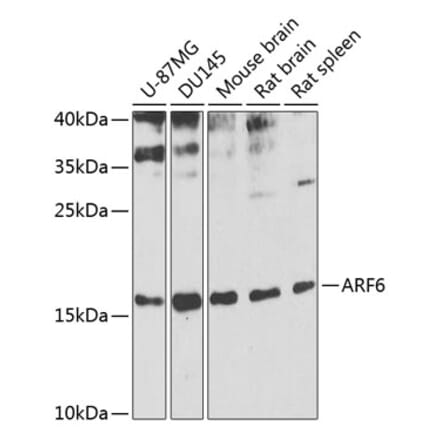 Western Blot - Anti-ARF6 Antibody (A12746) - Antibodies.com