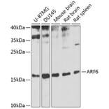 Western Blot - Anti-ARF6 Antibody (A12746) - Antibodies.com