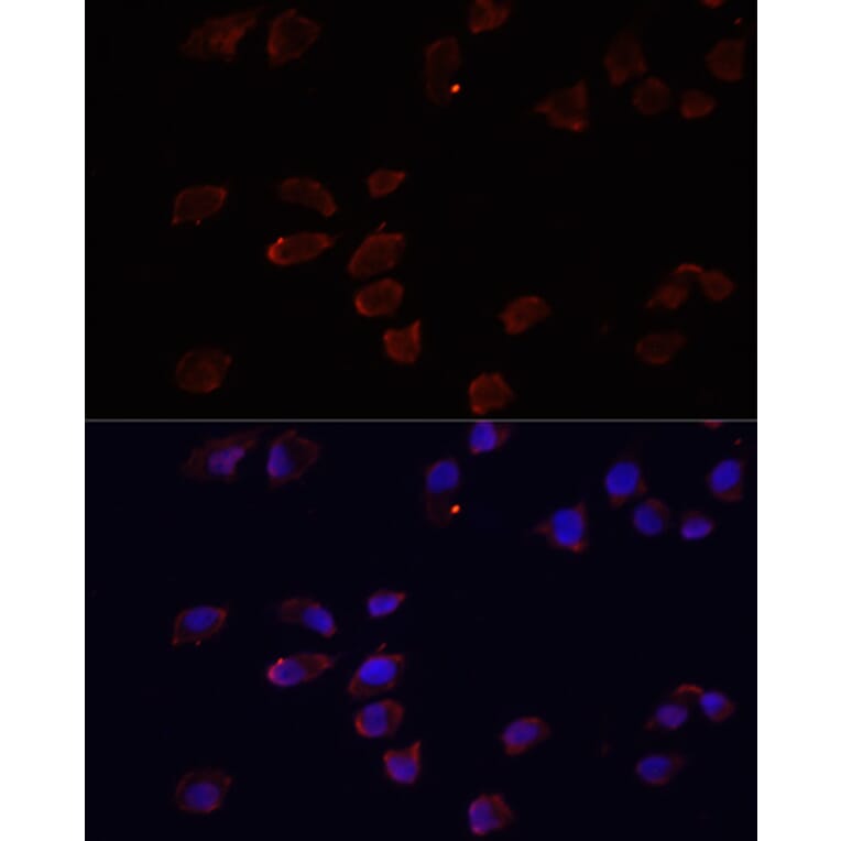 Immunofluorescence - Anti-ARF6 Antibody (A12746) - Antibodies.com