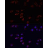Immunofluorescence - Anti-ARF6 Antibody (A12746) - Antibodies.com