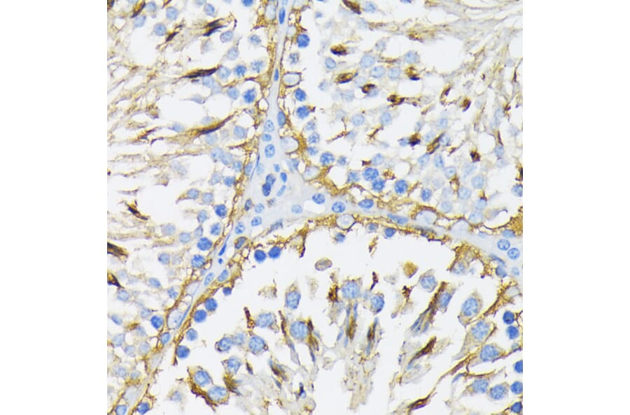 Immunohistochemistry - Anti-GRP94 Antibody (A12747) - Antibodies.com