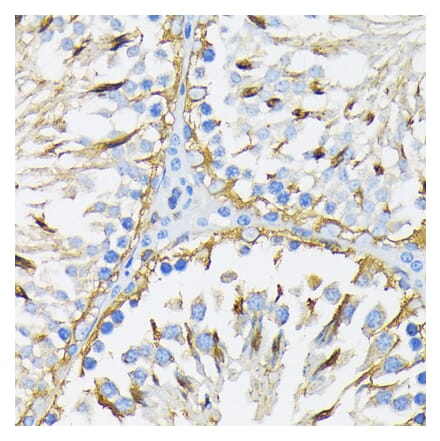 Immunohistochemistry - Anti-GRP94 Antibody (A12747) - Antibodies.com