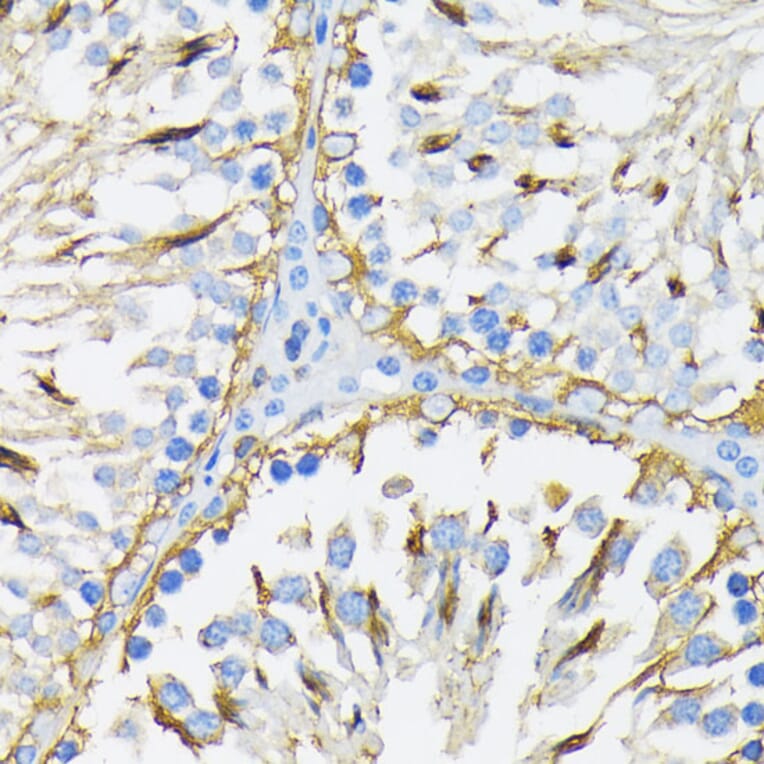 Immunohistochemistry - Anti-GRP94 Antibody (A12747) - Antibodies.com