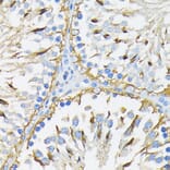 Immunohistochemistry - Anti-GRP94 Antibody (A12747) - Antibodies.com
