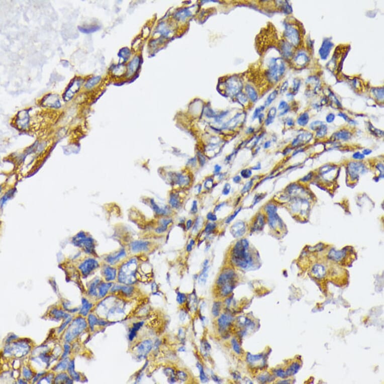 Immunohistochemistry - Anti-GRP94 Antibody (A12747) - Antibodies.com