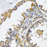 Immunohistochemistry - Anti-GRP94 Antibody (A12747) - Antibodies.com