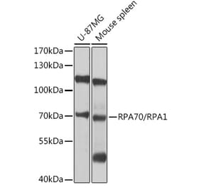 Western Blot - Anti-RPA70 Antibody (A12748) - Antibodies.com