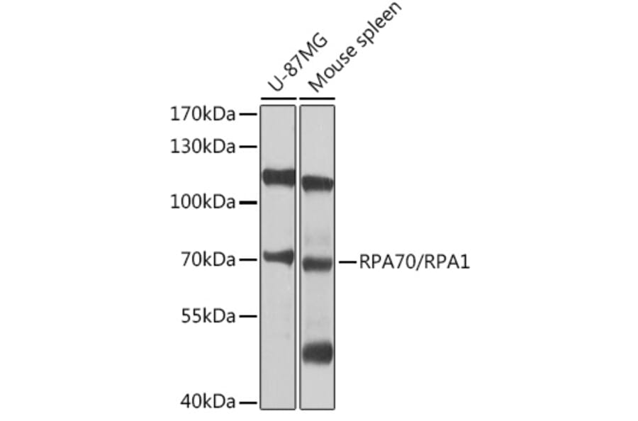 Western Blot - Anti-RPA70 Antibody (A12748) - Antibodies.com