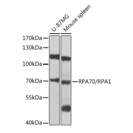 Western Blot - Anti-RPA70 Antibody (A12748) - Antibodies.com