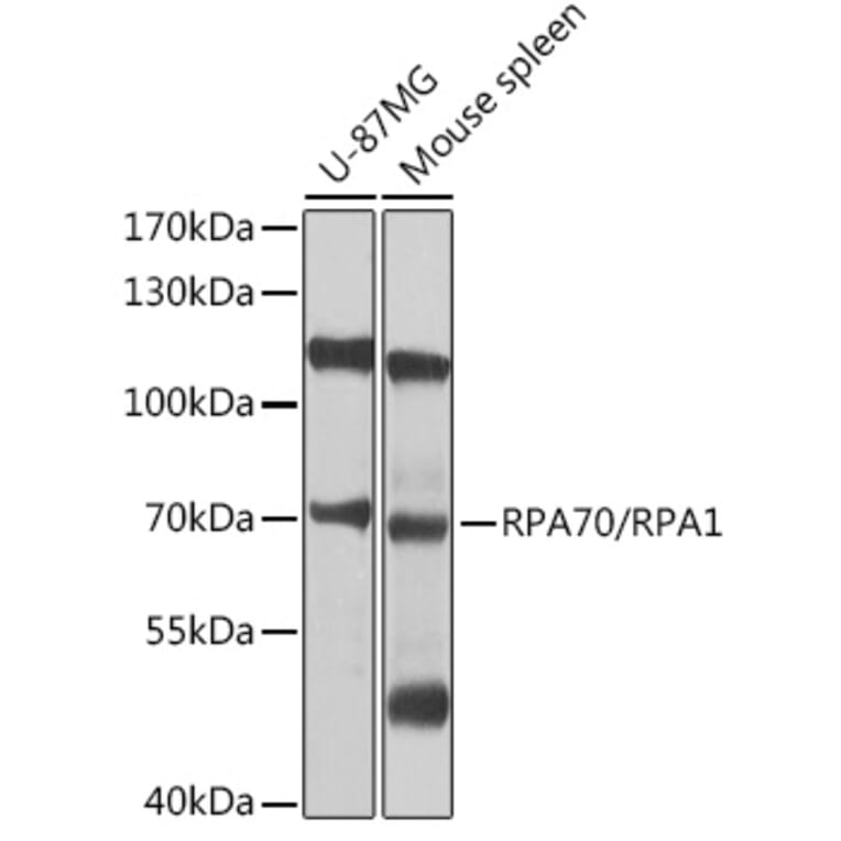 Western Blot - Anti-RPA70 Antibody (A12748) - Antibodies.com