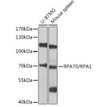 Western Blot - Anti-RPA70 Antibody (A12748) - Antibodies.com