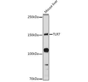 Western Blot - Anti-TLR7 Antibody (A12749) - Antibodies.com