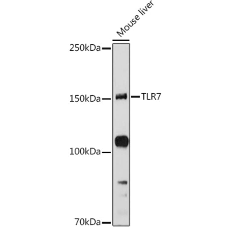 Western Blot - Anti-TLR7 Antibody (A12749) - Antibodies.com