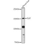 Western Blot - Anti-TLR7 Antibody (A12749) - Antibodies.com