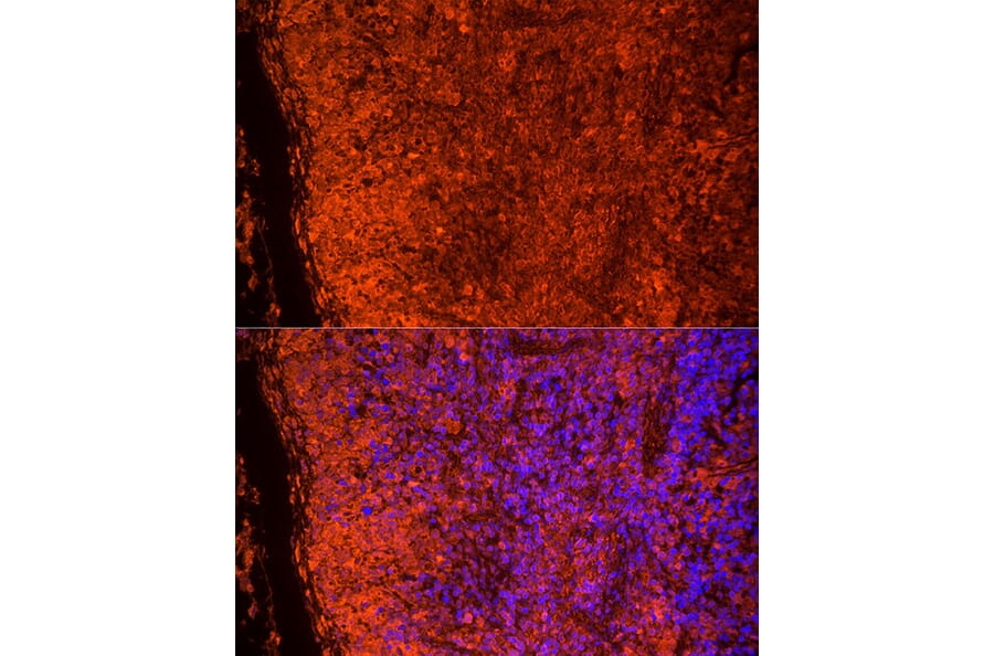 Immunofluorescence - Anti-TLR7 Antibody (A12749) - Antibodies.com