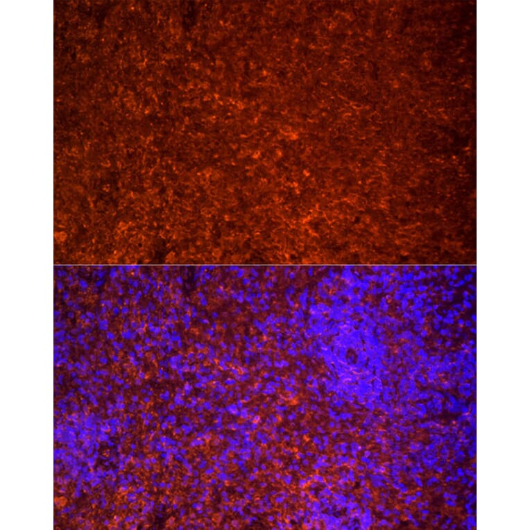 Immunofluorescence - Anti-TLR7 Antibody (A12749) - Antibodies.com