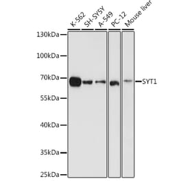 Western Blot - Anti-Synaptotagmin Antibody (A12750) - Antibodies.com