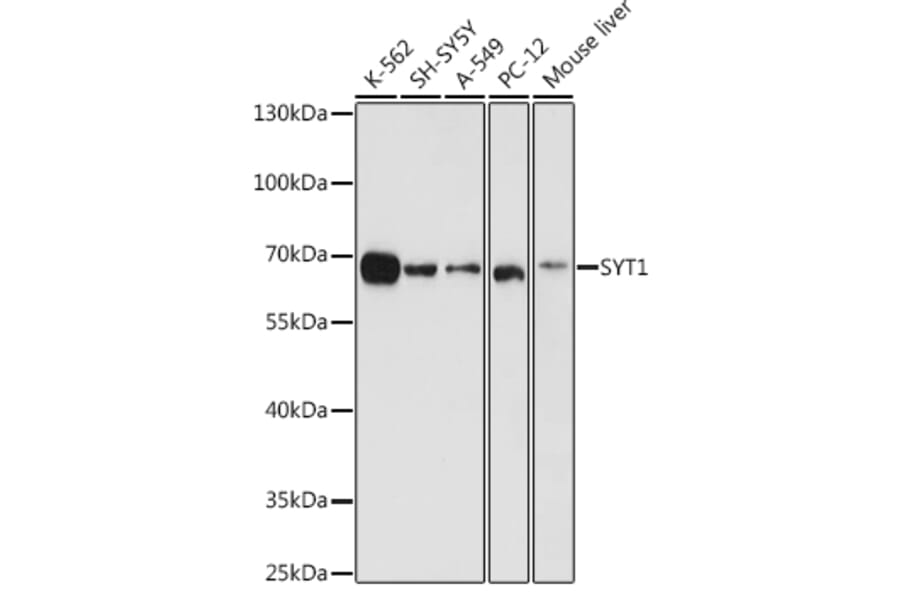 Western Blot - Anti-Synaptotagmin Antibody (A12750) - Antibodies.com