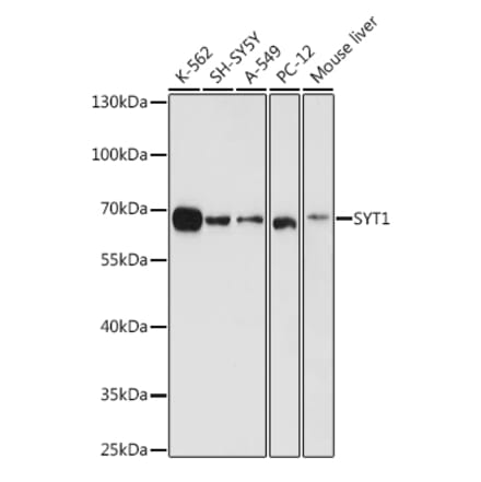 Western Blot - Anti-Synaptotagmin Antibody (A12750) - Antibodies.com