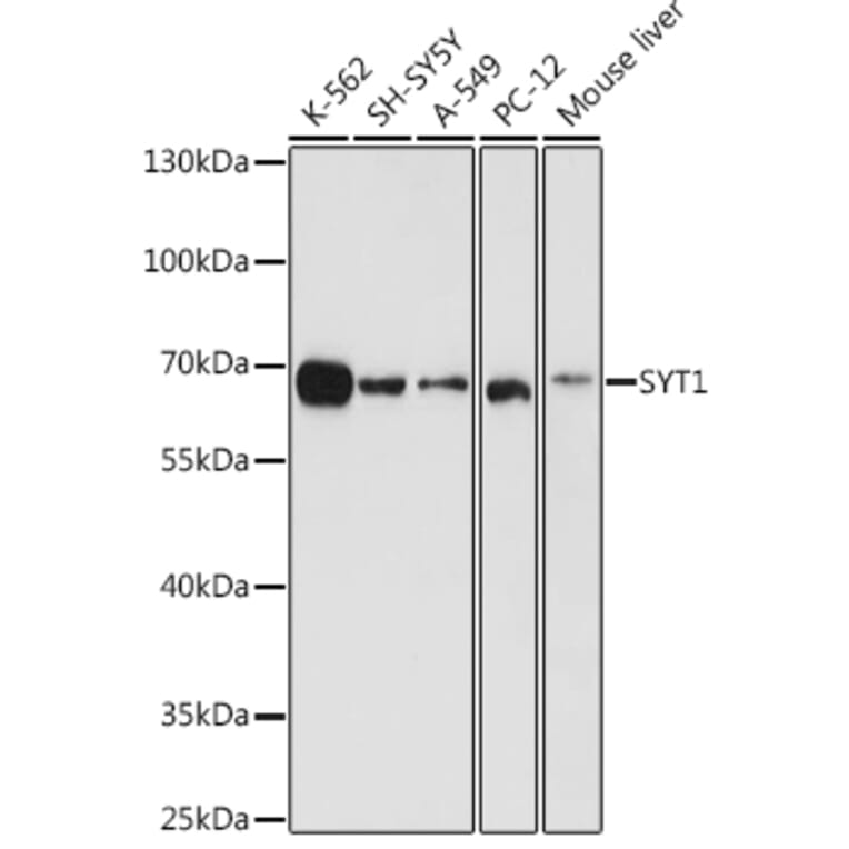 Western Blot - Anti-Synaptotagmin Antibody (A12750) - Antibodies.com