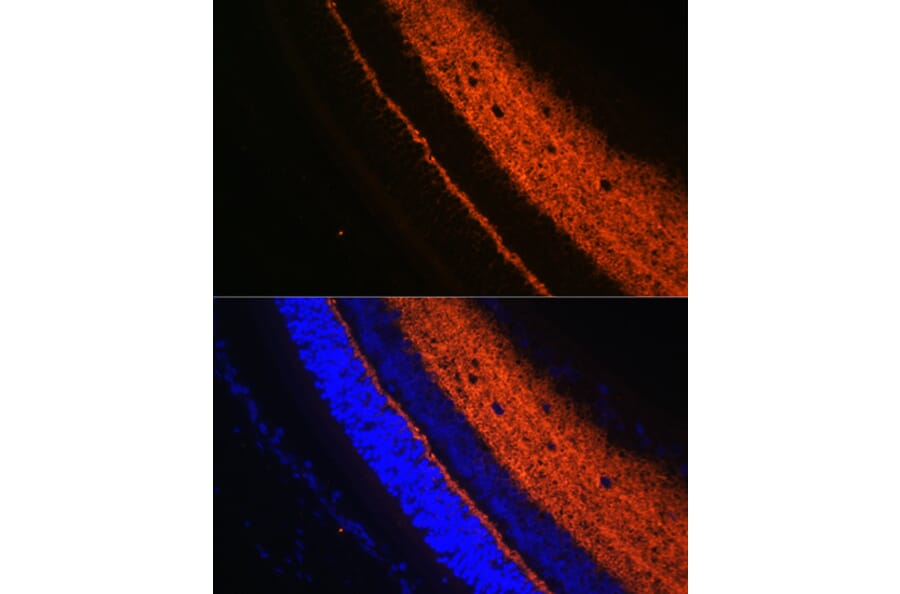 Immunofluorescence - Anti-Synaptotagmin Antibody (A12750) - Antibodies.com
