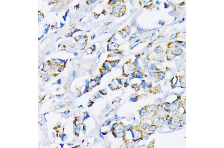 Immunohistochemistry - Anti-Hexokinase II Antibody (A12752) - Antibodies.com