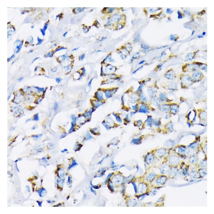 Immunohistochemistry - Anti-Hexokinase II Antibody (A12752) - Antibodies.com