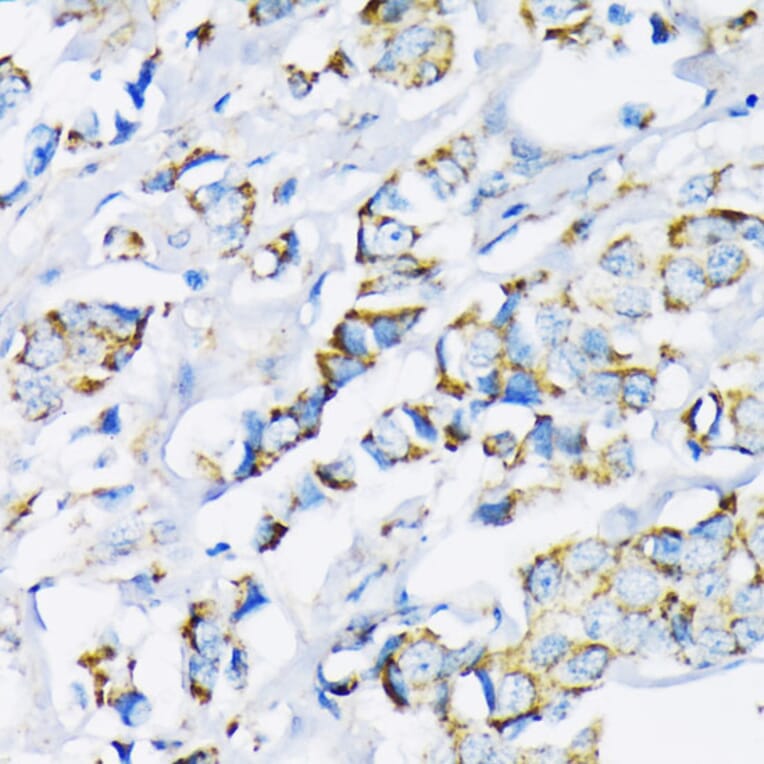 Immunohistochemistry - Anti-Hexokinase II Antibody (A12752) - Antibodies.com