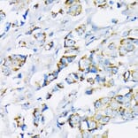 Immunohistochemistry - Anti-Hexokinase II Antibody (A12752) - Antibodies.com