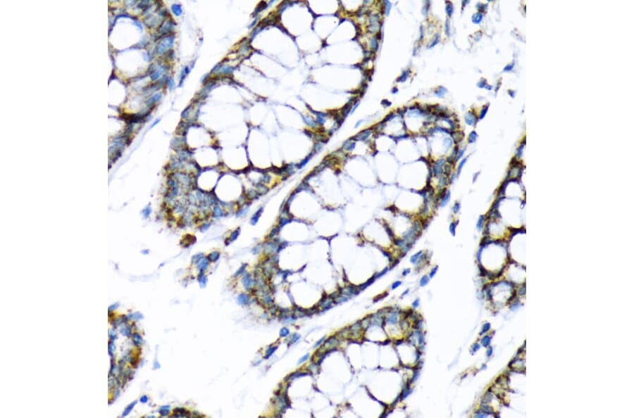 Immunohistochemistry - Anti-Hexokinase II Antibody (A12752) - Antibodies.com