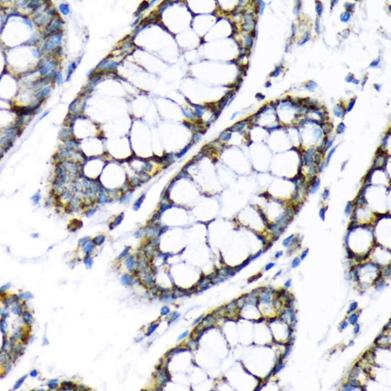 Immunohistochemistry - Anti-Hexokinase II Antibody (A12752) - Antibodies.com