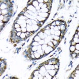 Immunohistochemistry - Anti-Hexokinase II Antibody (A12752) - Antibodies.com