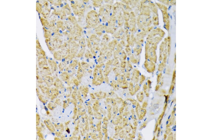 Immunohistochemistry - Anti-Hexokinase II Antibody (A12752) - Antibodies.com