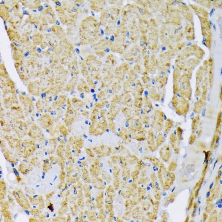 Immunohistochemistry - Anti-Hexokinase II Antibody (A12752) - Antibodies.com